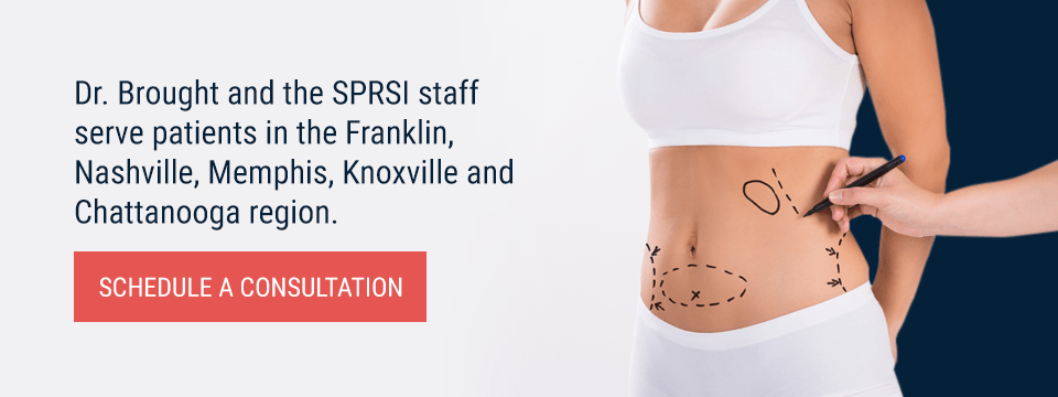 schedule tummy tuck in franklin TN